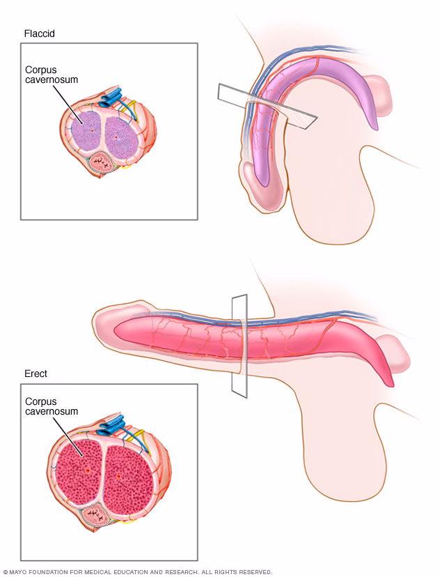 Can curcumin treat erectile dysfunction associated with Type 1 diabetes?