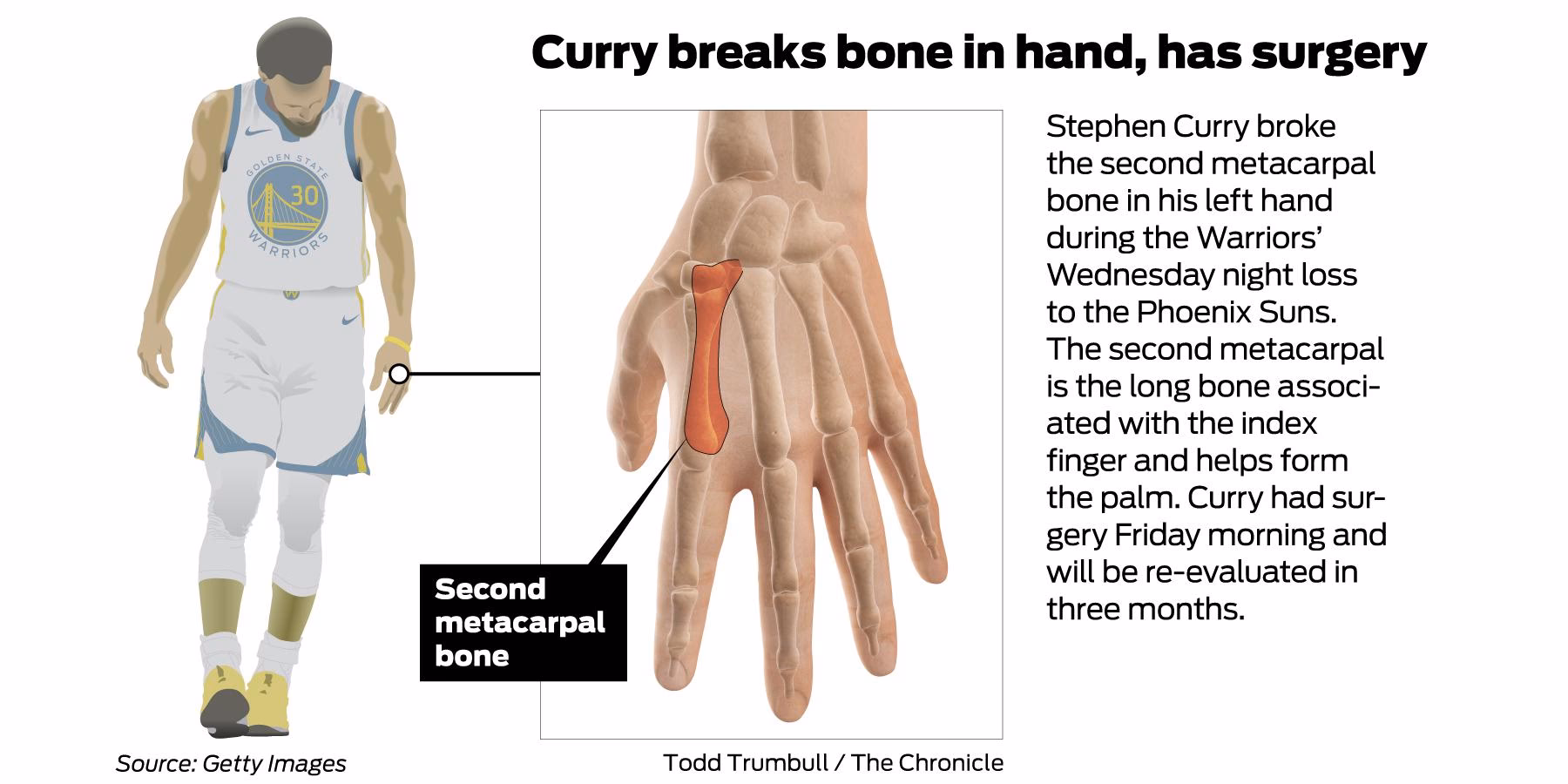 How big is Stephen Curry's hand?